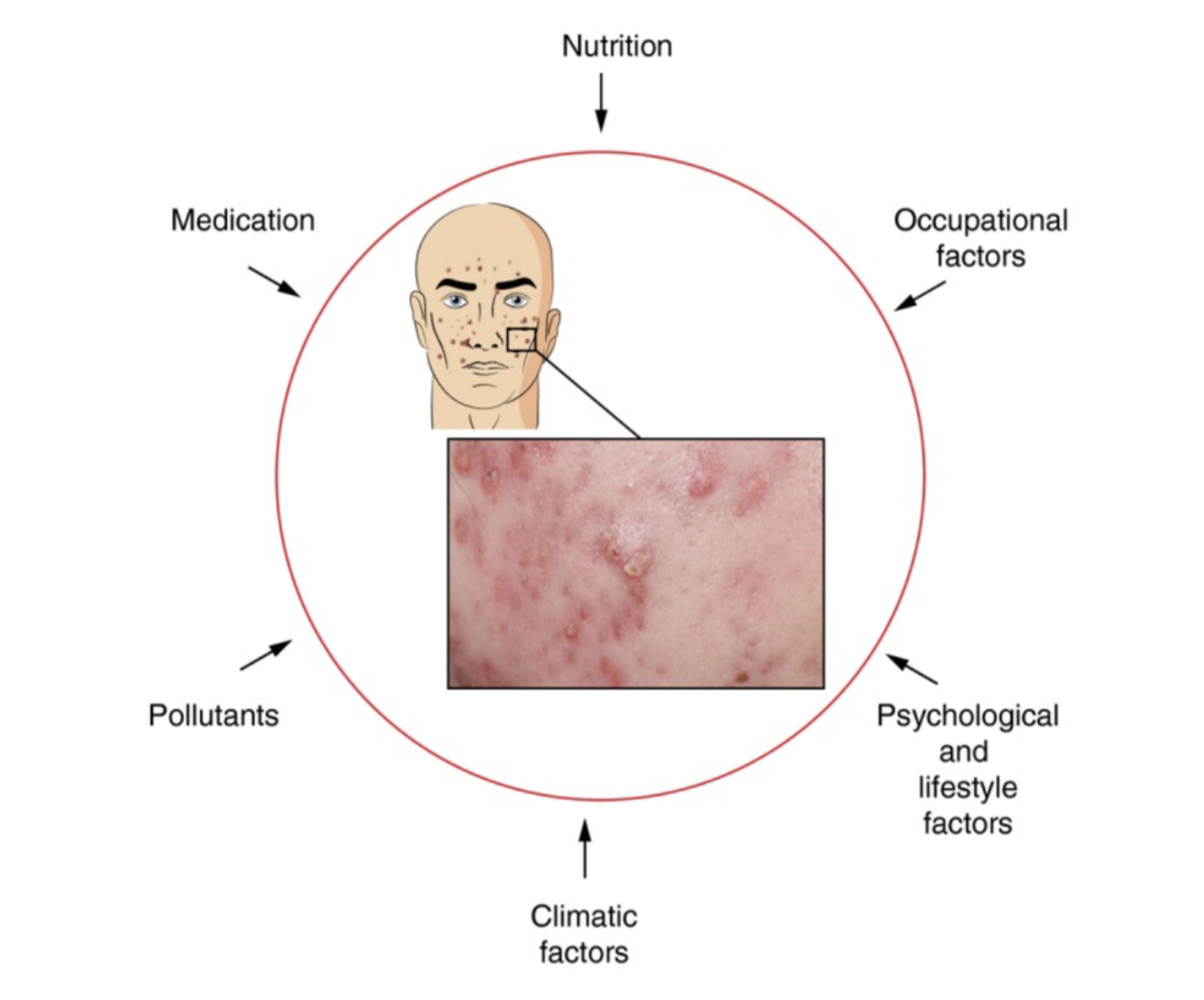 Exposome and Skin Care - NYSCC